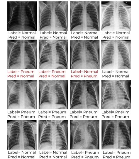 validity of chest x ray result|2015 Screening Chest X.